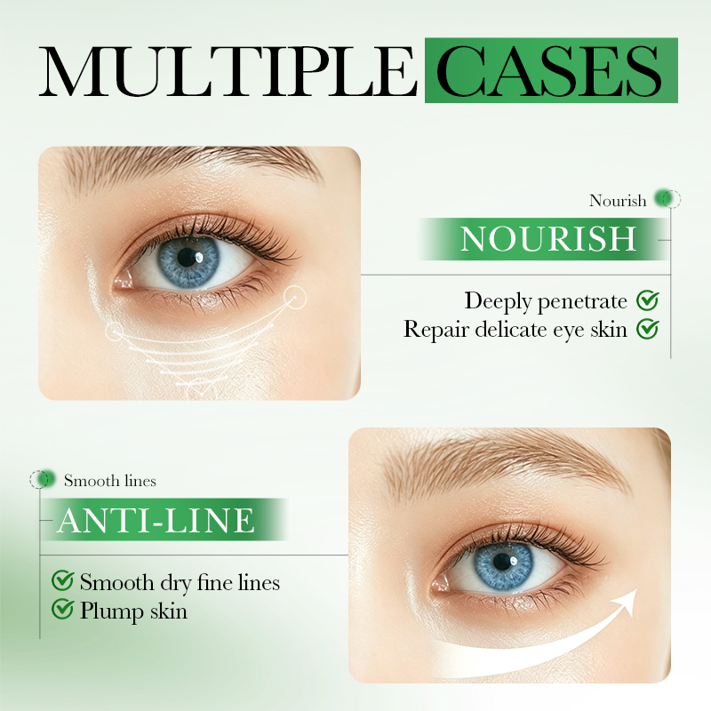 60pcs SADOER Centella Asiatica - Collagen Under Eye Patches 评论和价格